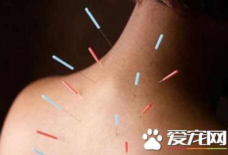针灸的好处与坏处 选择正规的中医院进行针灸
