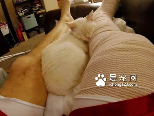 超可爱喵星人寸步不离 照顾腿打石膏的主人