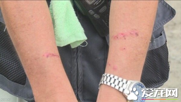 秋田犬没顾好冲河堤连咬3人 狗狗被抓