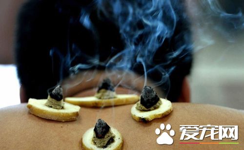 三伏灸可以吃海鲜吗 三伏灸完后多久才能吃海鲜