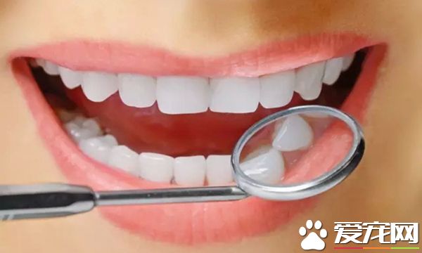 牙齿漂白多少钱 牙齿漂白有危害吗