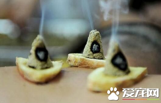 艾灸多少钱一次2017 艾灸前后如何护理