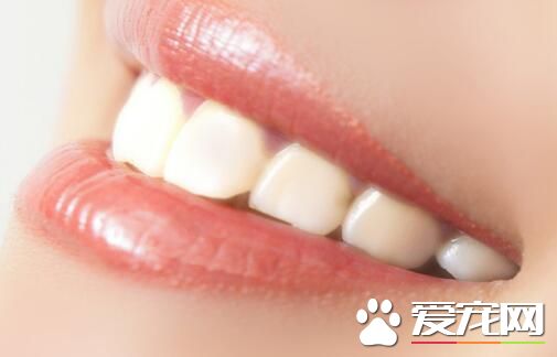 洗牙之后不能吃什么 洗牙之后不能吃的食物