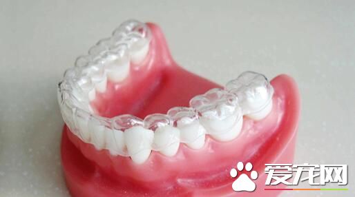 隐形牙套和钢丝牙套哪个效果好 隐形牙套有什么优势