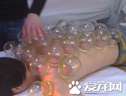 拔罐后吹空调会怎样 拔火罐后多久可以吹空调