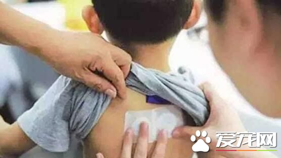 贴三伏贴可以洗澡吗 贴三伏贴后多久可以洗澡