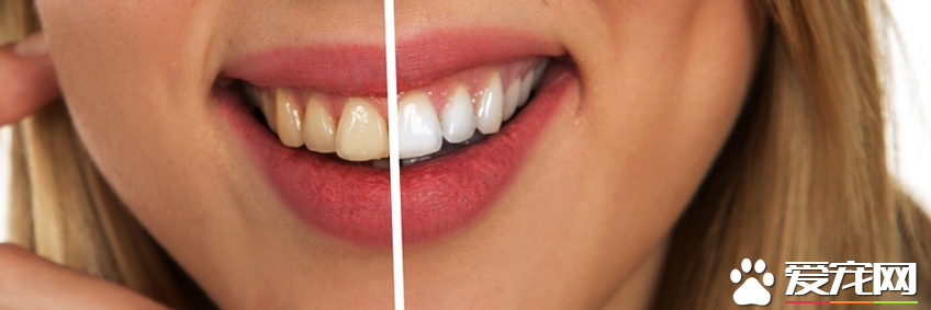 电动牙刷使用方法 如何正确的使用电动牙刷