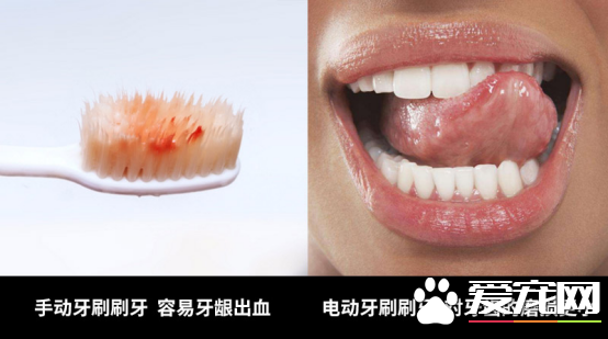 电动牙刷使用方法 如何正确的使用电动牙刷