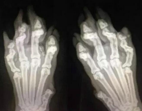 猫爪X光 骨折了吗？有点可爱怎么回事