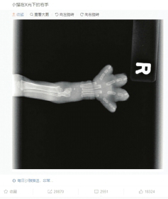 猫爪X光 骨折了吗？有点可爱怎么回事