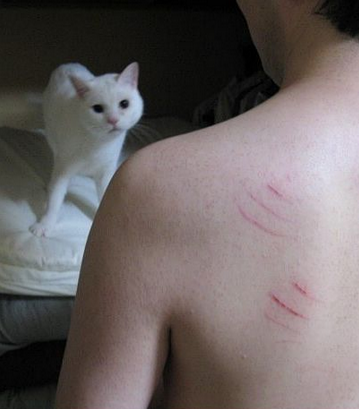 我们被猫抓成这样怎么还没死？