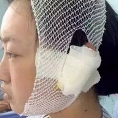 狗主因自家小狗被路人骂而狠心咬掉对方耳朵